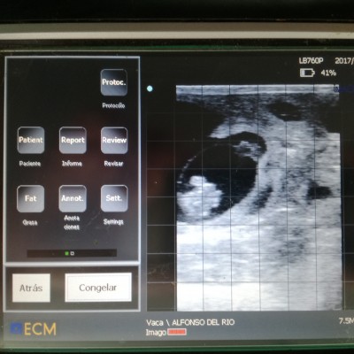 Embrión de 46 días